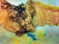 Resistant Starch and Colon Cancer